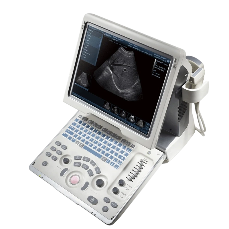 Mindray Z6 abierto mostrando pantalla